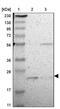 Uncharacterized protein C1orf93 homolog antibody, PA5-52290, Invitrogen Antibodies, Western Blot image 