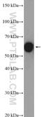 Chaperonin Containing TCP1 Subunit 8 antibody, 12263-1-AP, Proteintech Group, Western Blot image 