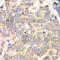 Hydroxyacylglutathione Hydrolase antibody, A6615, ABclonal Technology, Immunohistochemistry paraffin image 