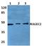 MAGE Family Member C2 antibody, PA5-37071, Invitrogen Antibodies, Western Blot image 