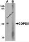 Glycerophosphodiester Phosphodiesterase Domain Containing 5 antibody, 7739, ProSci, Western Blot image 
