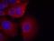 Glycogen Synthase Kinase 3 Alpha antibody, NB100-81943, Novus Biologicals, Immunocytochemistry image 