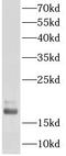 Fragile Histidine Triad Diadenosine Triphosphatase antibody, FNab03108, FineTest, Western Blot image 