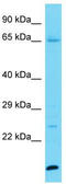 Keratinocyte Proline Rich Protein antibody, TA332250, Origene, Western Blot image 