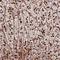 TRNA Methyltransferase Subunit 11-2 antibody, NBP1-92009, Novus Biologicals, Immunohistochemistry paraffin image 