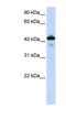 Surfactant Protein B antibody, NBP1-57977, Novus Biologicals, Western Blot image 