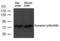 Synapsin I antibody, PA5-37748, Invitrogen Antibodies, Western Blot image 