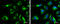 Superoxide Dismutase 2 antibody, GTX630560, GeneTex, Immunofluorescence image 