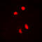Heat Shock Transcription Factor 1 antibody, LS-C356117, Lifespan Biosciences, Immunofluorescence image 