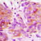 Microtubule Affinity Regulating Kinase 2 antibody, LS-C368416, Lifespan Biosciences, Immunohistochemistry frozen image 