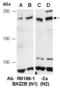 Bromodomain Adjacent To Zinc Finger Domain 2B antibody, R0189-2a, Abiocode, Western Blot image 