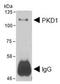 Protein Kinase D1 antibody, orb373009, Biorbyt, Western Blot image 