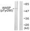 WAS antibody, LS-C199730, Lifespan Biosciences, Western Blot image 