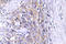 CLN6 Transmembrane ER Protein antibody, LS-C177359, Lifespan Biosciences, Immunohistochemistry paraffin image 