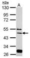 Eukaryotic Translation Initiation Factor 3 Subunit E antibody, PA5-29487, Invitrogen Antibodies, Western Blot image 