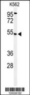 Calcium uptake protein 1, mitochondrial antibody, 64-064, ProSci, Western Blot image 