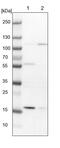 Integrin Subunit Beta 6 antibody, PA5-54848, Invitrogen Antibodies, Western Blot image 