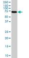 Myristoylated Alanine Rich Protein Kinase C Substrate antibody, H00004082-M04, Novus Biologicals, Western Blot image 