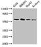 Prolyl 4-Hydroxylase Subunit Alpha 1 antibody, CSB-PA017339LA01HU, Cusabio, Western Blot image 