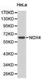 NADPH Oxidase 4 antibody, LS-C192965, Lifespan Biosciences, Western Blot image 