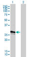 Gap Junction Protein Beta 3 antibody, LS-C197300, Lifespan Biosciences, Western Blot image 