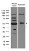 Matrix Metallopeptidase 11 antibody, LS-C796643, Lifespan Biosciences, Western Blot image 