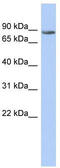 Transmembrane And Tetratricopeptide Repeat Containing 1 antibody, TA331005, Origene, Western Blot image 