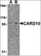 Caspase Recruitment Domain Family Member 10 antibody, orb86705, Biorbyt, Western Blot image 