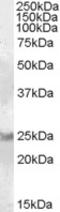 RAB8A, Member RAS Oncogene Family antibody, EB08311, Everest Biotech, Western Blot image 