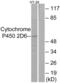 Cytochrome P450 Family 2 Subfamily D Member 6 antibody, abx013986, Abbexa, Western Blot image 