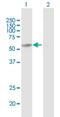 Chaperonin Containing TCP1 Subunit 6B antibody, H00010693-B01P, Novus Biologicals, Western Blot image 