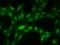 A0A023HHK9 antibody, 202731-T02, Sino Biological, Immunohistochemistry paraffin image 