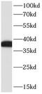 Fc Fragment Of IgE Receptor II antibody, FNab01447, FineTest, Western Blot image 