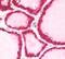 Arrestin Beta 2 antibody, PA5-23296, Invitrogen Antibodies, Immunohistochemistry paraffin image 