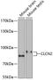 Chloride Voltage-Gated Channel 2 antibody, A04078, Boster Biological Technology, Western Blot image 