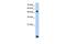 Radical S-Adenosyl Methionine Domain Containing 2 antibody, GTX46970, GeneTex, Western Blot image 