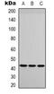 Insulin Like Growth Factor Binding Protein 3 antibody, orb338990, Biorbyt, Western Blot image 