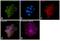 Integrin Subunit Beta 4 antibody, MA5-17104, Invitrogen Antibodies, Immunofluorescence image 