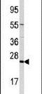 Trafficking Protein Particle Complex 4 antibody, PA5-11522, Invitrogen Antibodies, Western Blot image 