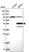 Abhydrolase Domain Containing 2 antibody, PA5-52239, Invitrogen Antibodies, Western Blot image 