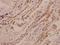 Glutamate Ionotropic Receptor AMPA Type Subunit 4 antibody, A07044, Boster Biological Technology, Immunohistochemistry paraffin image 