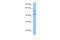 Programmed Cell Death 2 Like antibody, 30-652, ProSci, Enzyme Linked Immunosorbent Assay image 