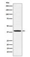 Atrogin-1 antibody, M02531-1, Boster Biological Technology, Western Blot image 