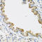 Cyclin Dependent Kinase Inhibitor 2C antibody, 18-463, ProSci, Immunohistochemistry paraffin image 