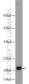 ADP Ribosylation Factor 1 antibody, 20226-1-AP, Proteintech Group, Western Blot image 