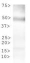 Tryptophan Hydroxylase 2 antibody, NBP1-77559, Novus Biologicals, Western Blot image 