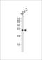 Glutathione S-Transferase Mu 4 antibody, 61-024, ProSci, Western Blot image 