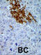 Pregnancy Up-Regulated Nonubiquitous CaM Kinase antibody, 62-658, ProSci, Western Blot image 