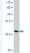 TACO antibody, H00011151-M03, Novus Biologicals, Western Blot image 