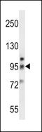Glutamate Metabotropic Receptor 6 antibody, 58-482, ProSci, Western Blot image 